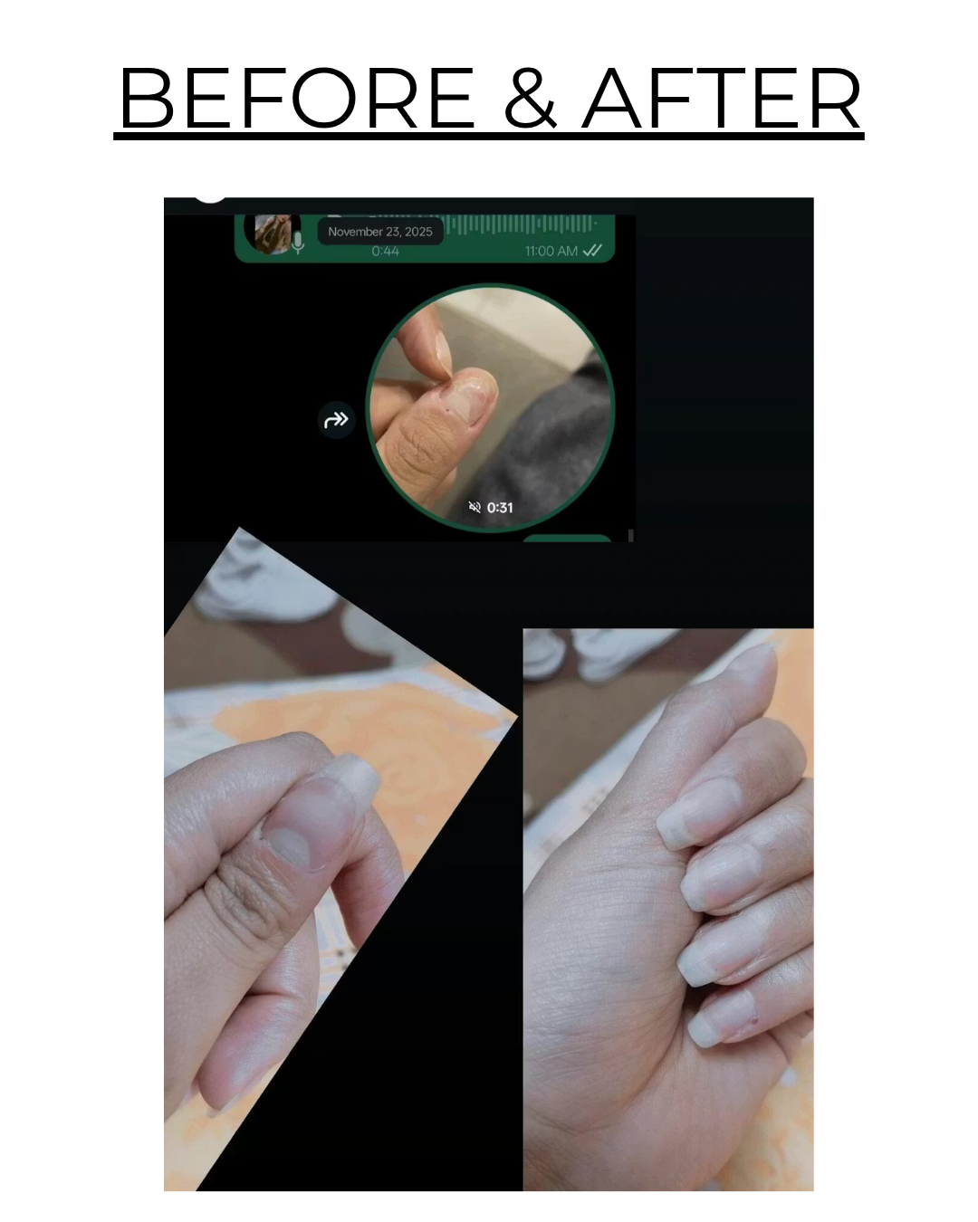 before & after