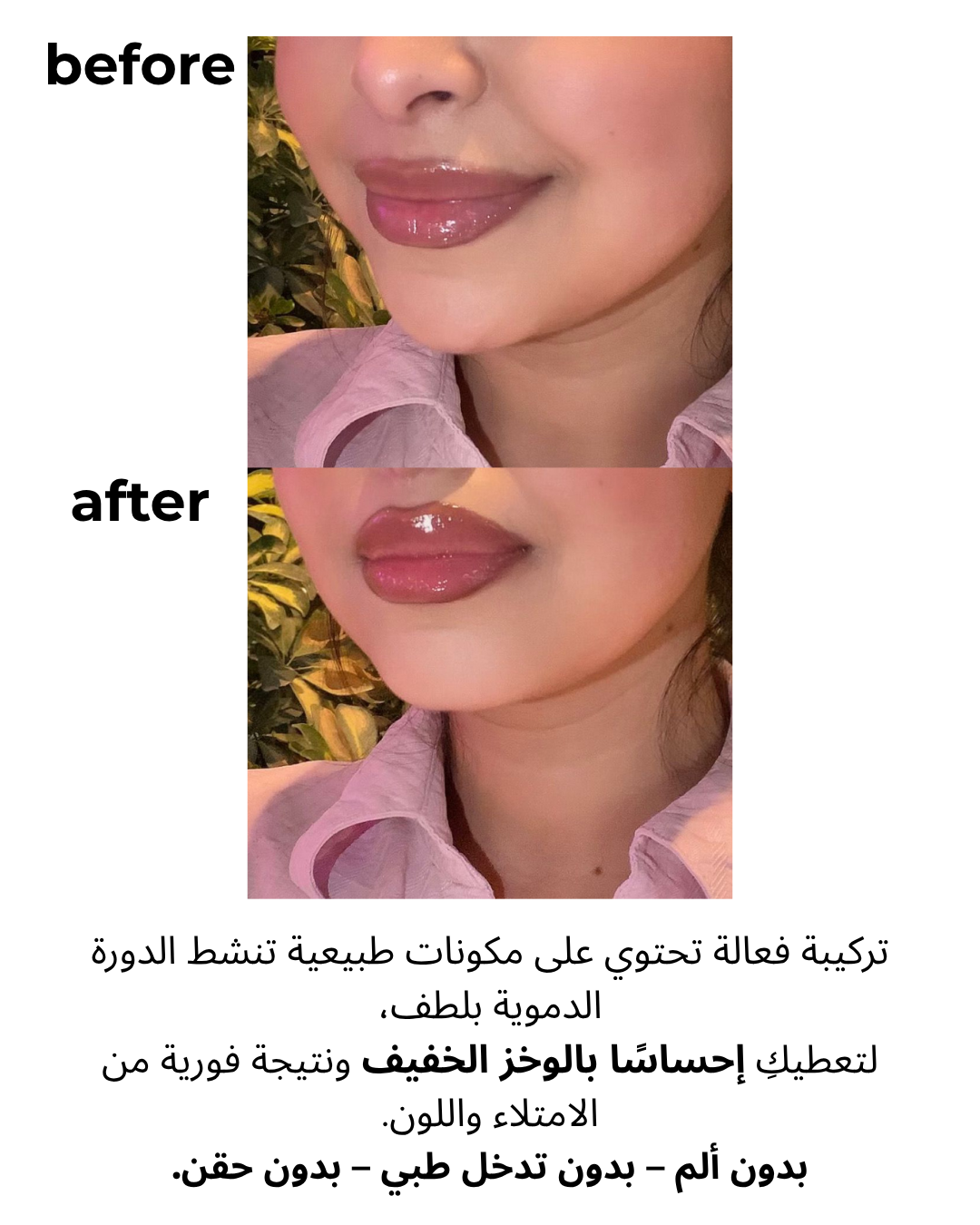 Safira Lip Plumping